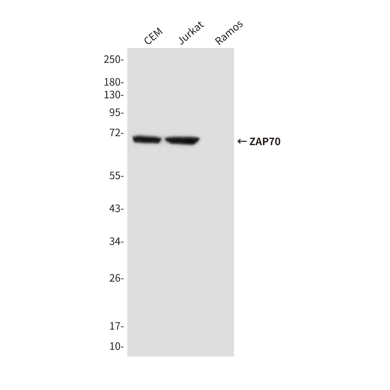 Anti-ZAP70 (4B2) Mouse Monoclonal Antibody