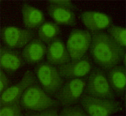 Anti-Rad23B (5H1) Mouse Monoclonal Antibody