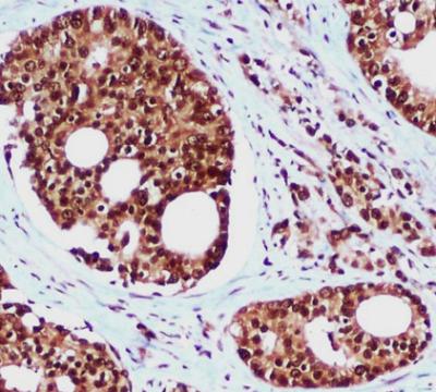 Anti-Rad23B (5H1) Mouse Monoclonal Antibody