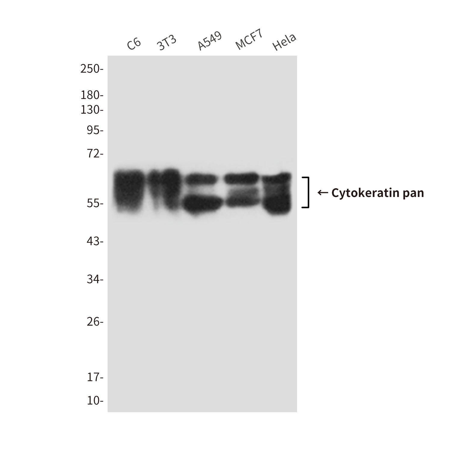 Anti-Cytokeratin pan (7H5) Mouse Monoclonal Antibody