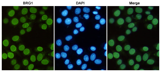 Anti-BRG1 (6D7) Mouse Monoclonal Antibody