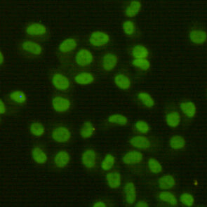 Anti-FEN1 (7H8) Mouse Monoclonal Antibody