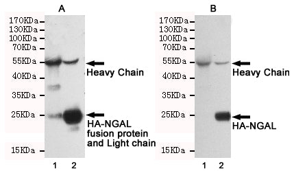 Anti-Rabbit IgG (5B2) Mouse Monoclonal Antibody