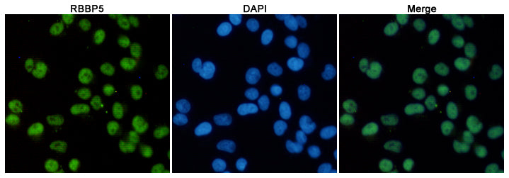 Anti-RBBP5 (1C9) Mouse Monoclonal Antibody