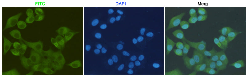 Anti-S100A10 (6F4) Mouse Monoclonal Antibody