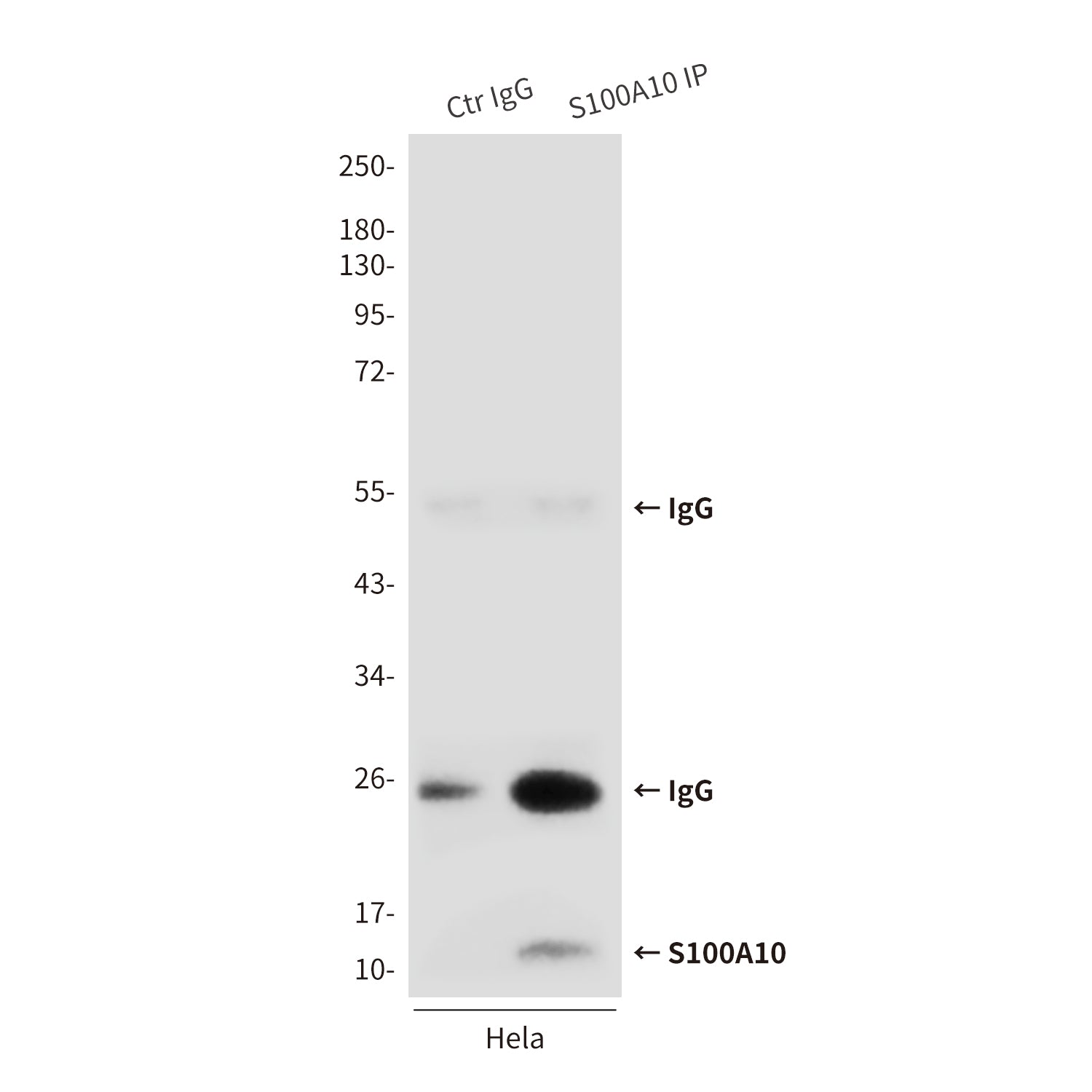 Anti-S100A10 (6F4) Mouse Monoclonal Antibody