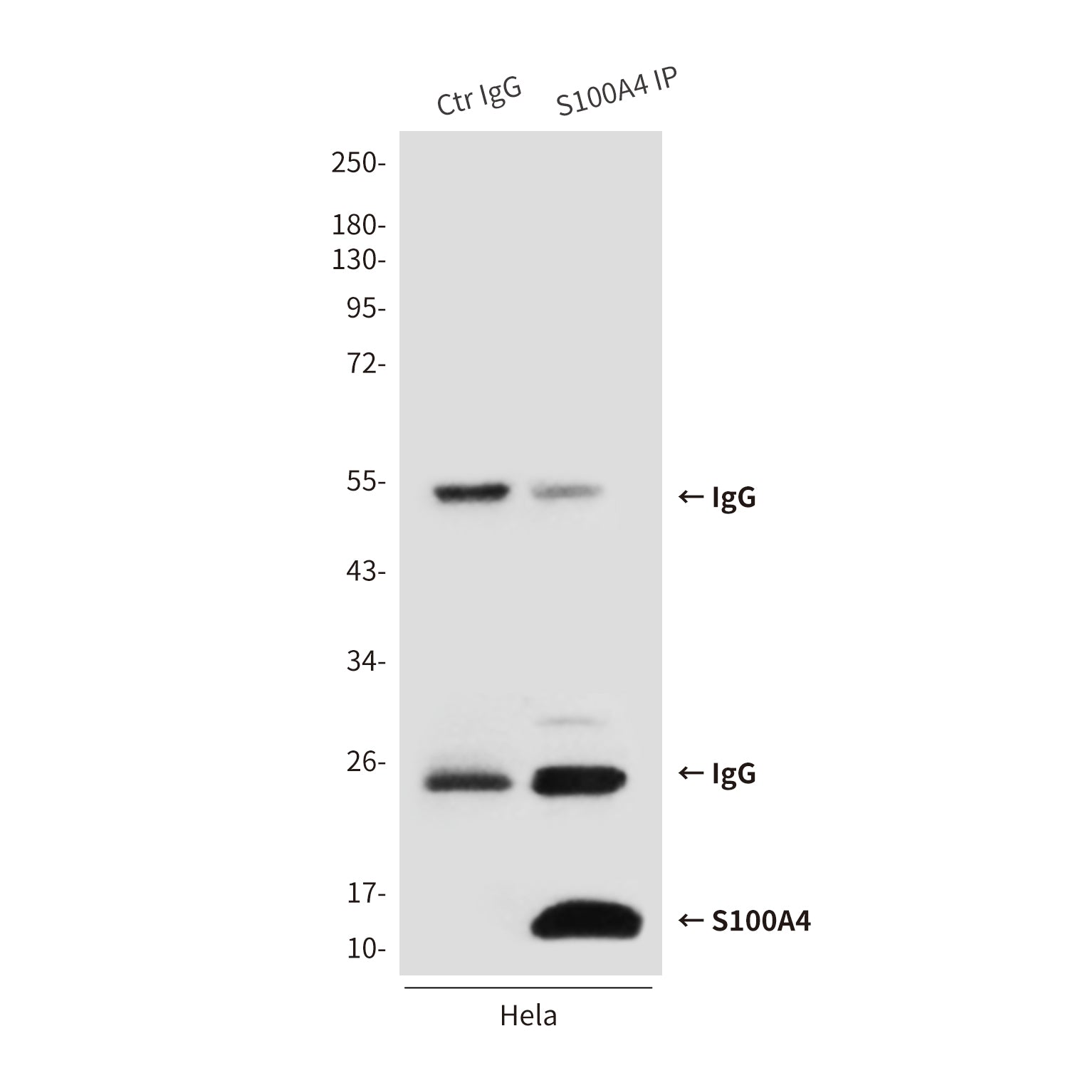 Anti-S100A4 (3D10) Mouse Monoclonal Antibody