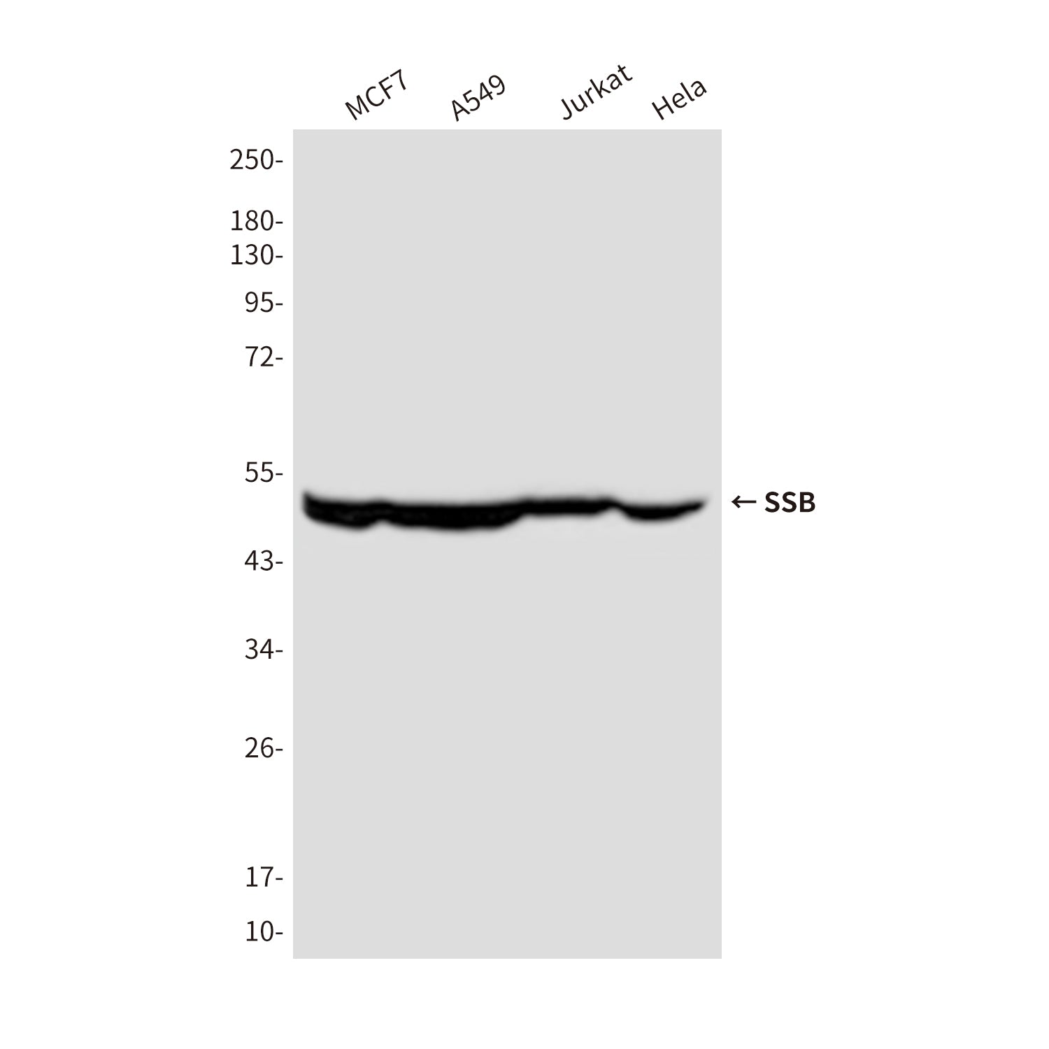 Anti-SSB (4B10) Mouse Monoclonal Antibody