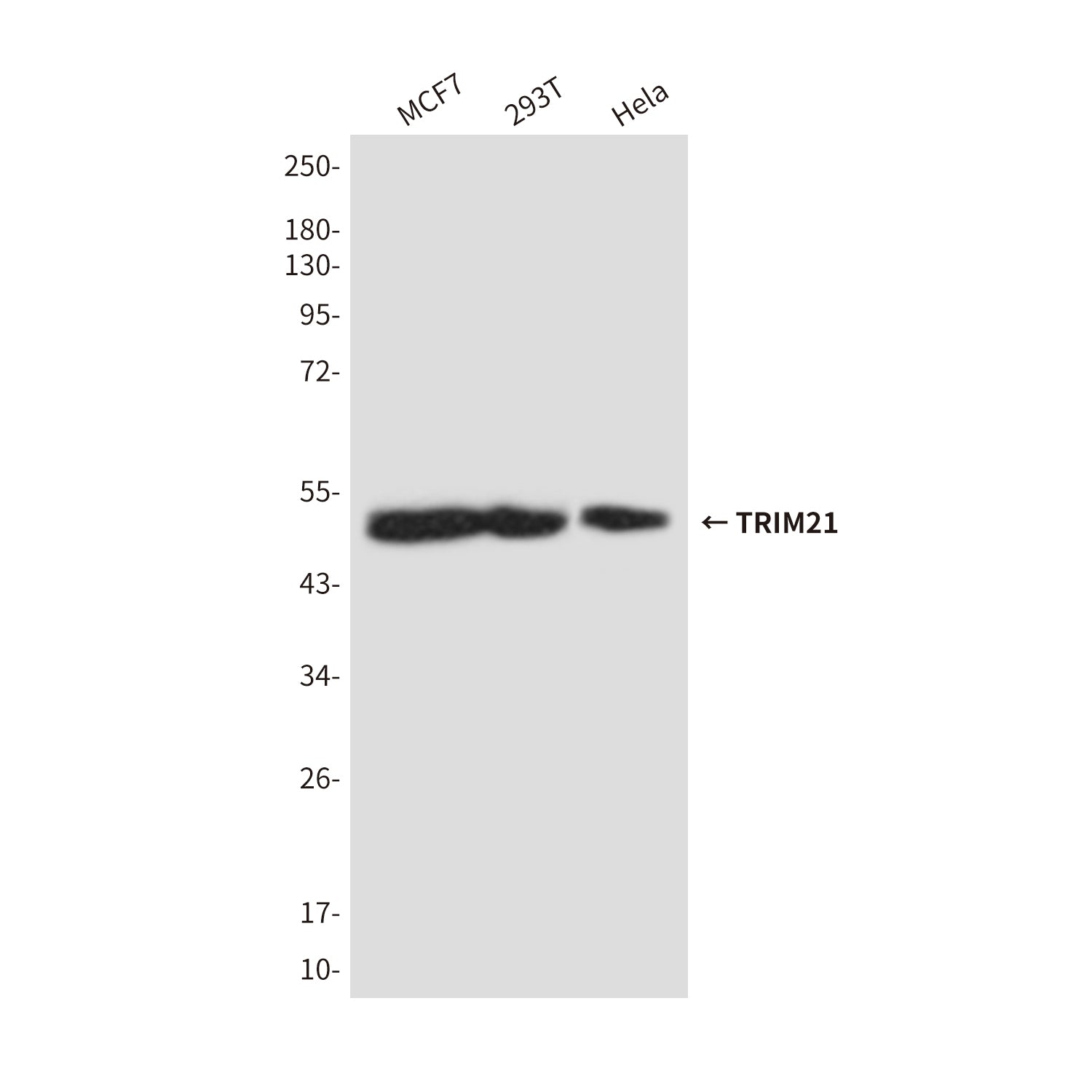 Anti-TRIM21 (5B9) Mouse Monoclonal Antibody
