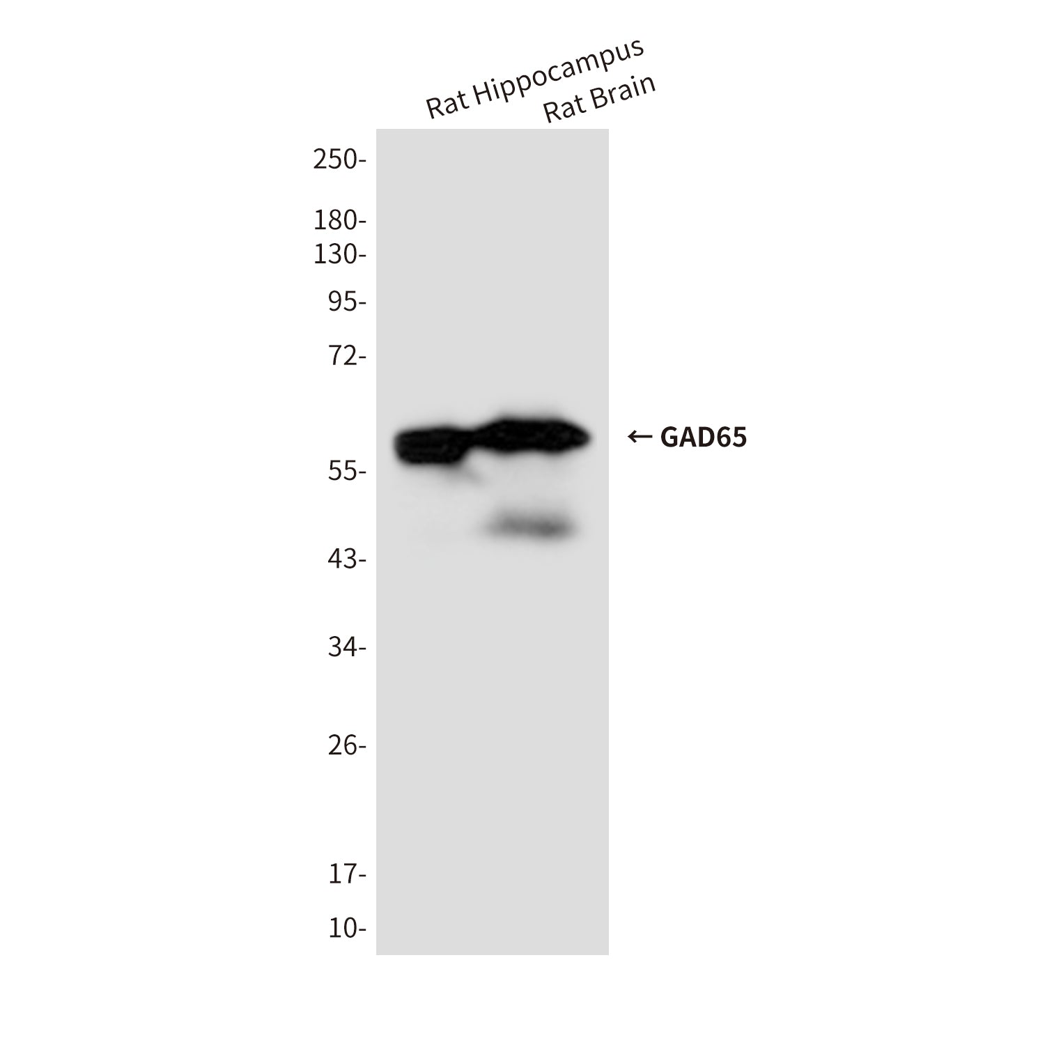 Anti-GAD65 (6D5) Mouse Monoclonal Antibody