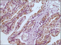 Anti-GST3 (9D4) Mouse Monoclonal Antibody