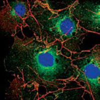 Anti-LPP (6F6) Mouse Monoclonal Antibody