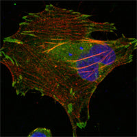 Anti-LPP (6F6) Mouse Monoclonal Antibody