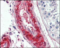 Anti-LPP (6F6) Mouse Monoclonal Antibody