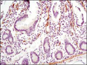 Anti-LPP (6F6) Mouse Monoclonal Antibody