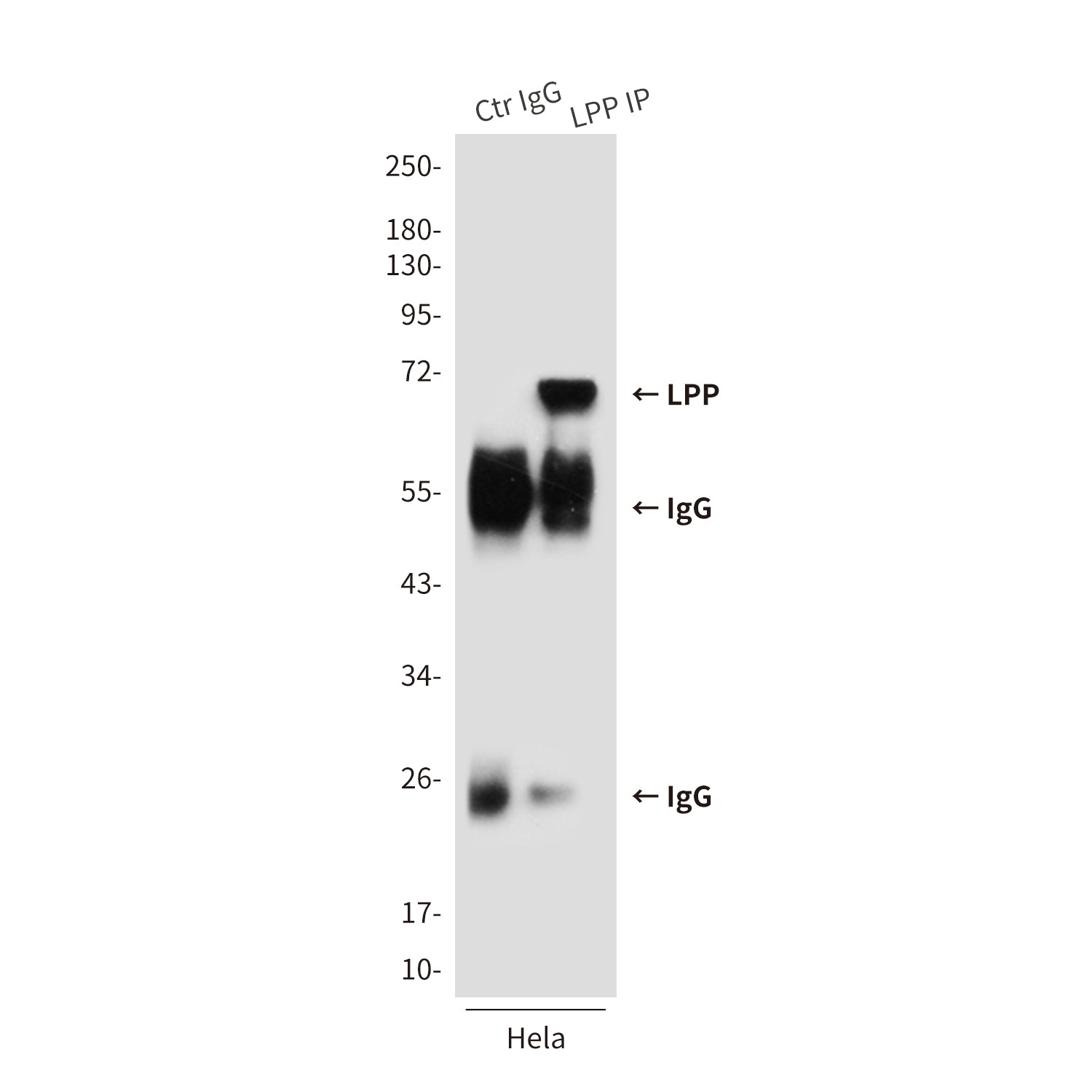 Anti-LPP (6F6) Mouse Monoclonal Antibody