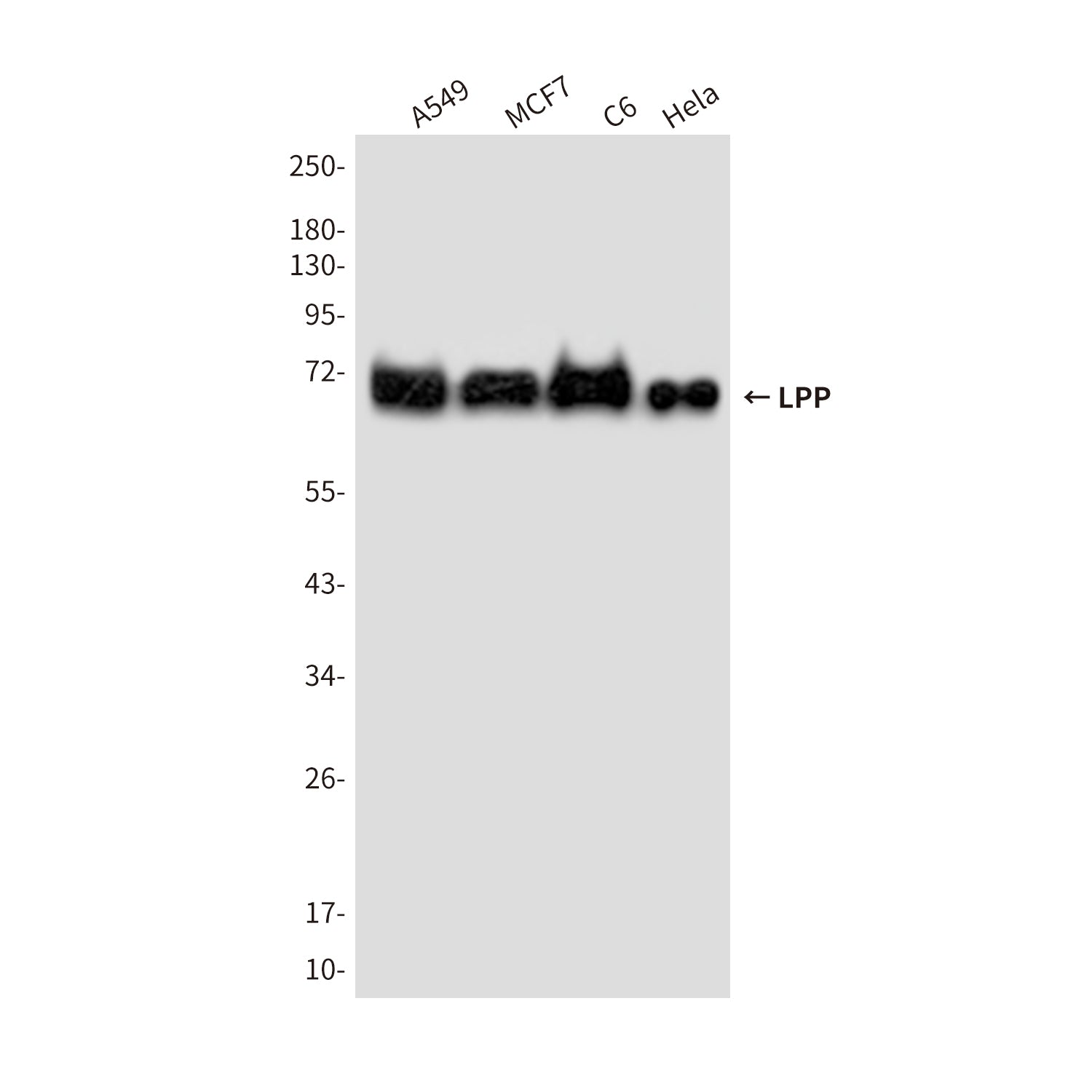 Anti-LPP (6F6) Mouse Monoclonal Antibody