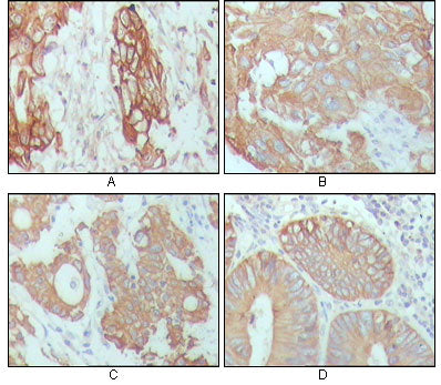 Anti-Cytokeratin 18 (6A8) Mouse Monoclonal Antibody