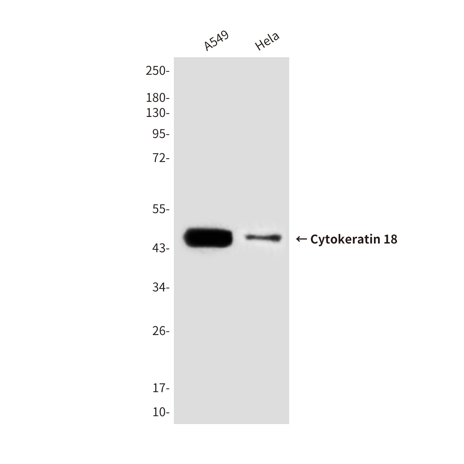 Anti-Cytokeratin 18 (6A8) Mouse Monoclonal Antibody