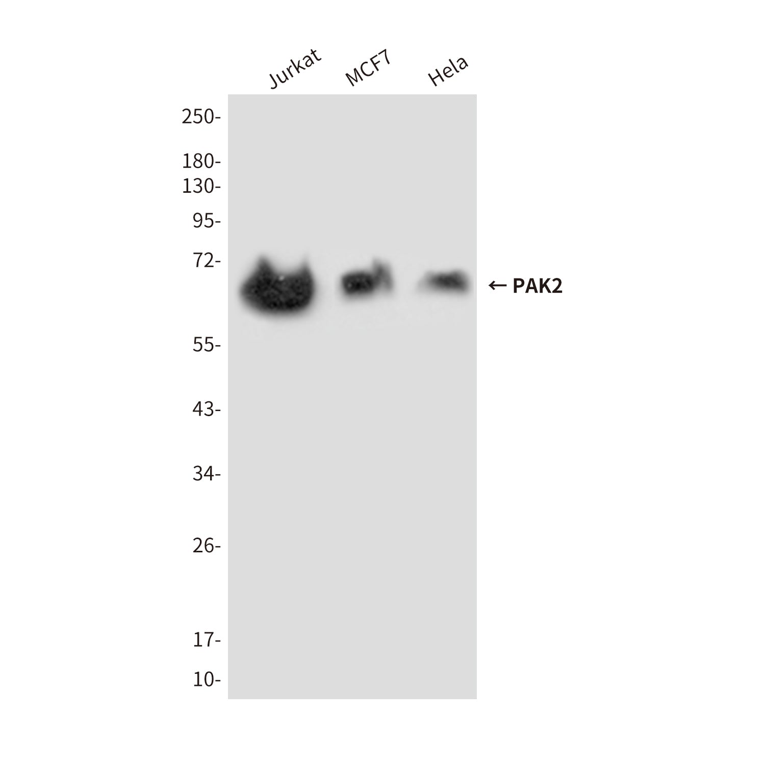 Anti-PAK2 (7H3) Mouse Monoclonal Antibody