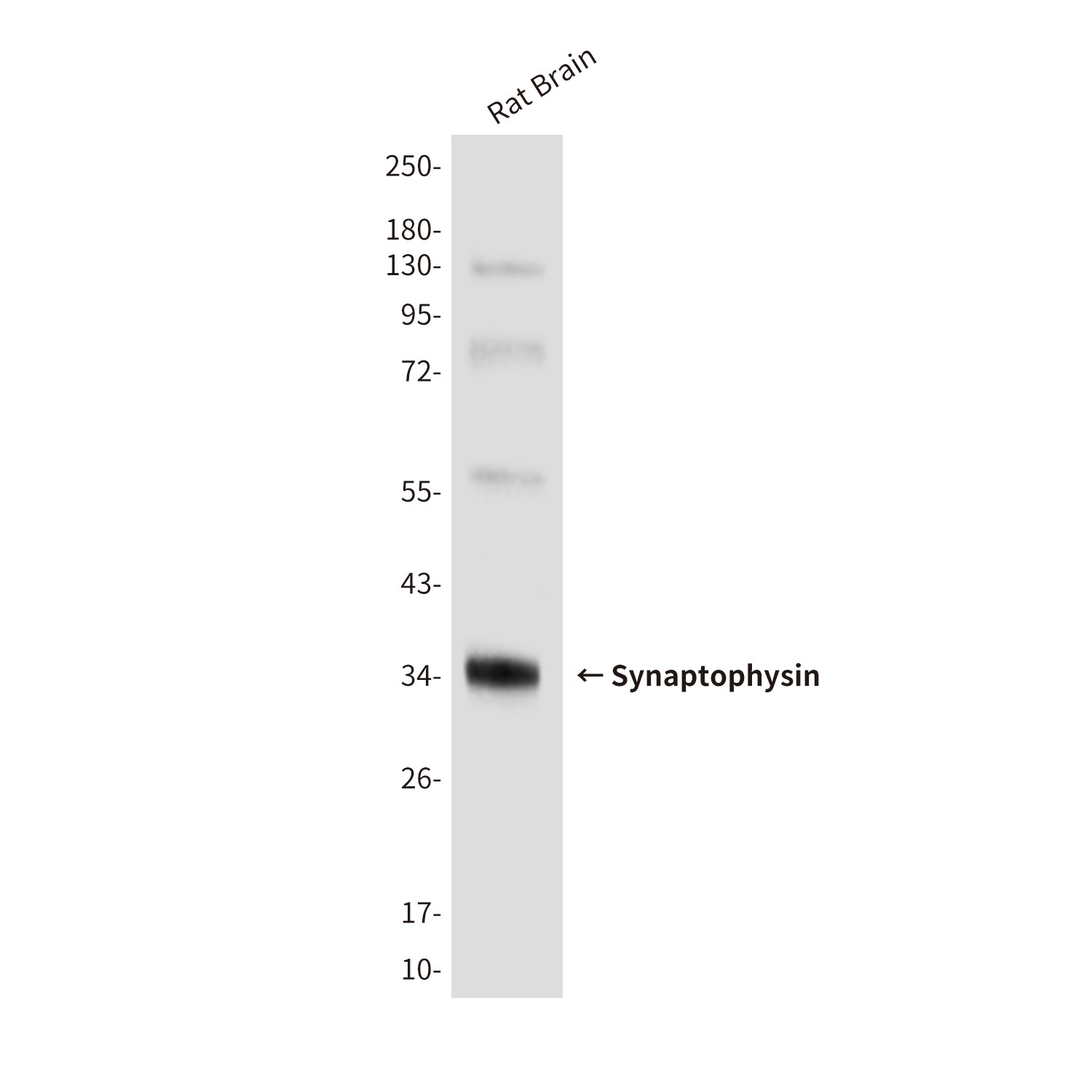 Anti-Synaptophysin (10C8) Mouse Monoclonal Antibody
