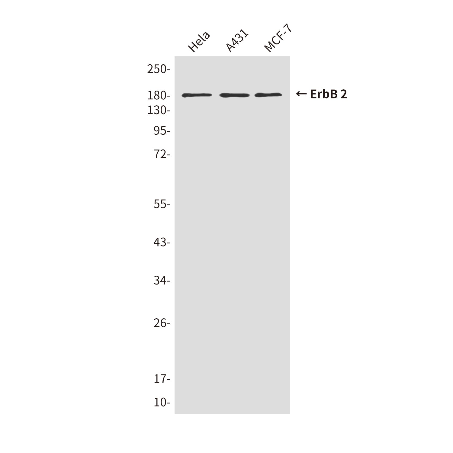 Anti-ErbB 2 (1C4) Mouse Monoclonal Antibody