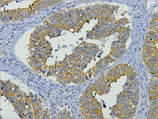Anti-Cytokeratin 19 (10G10) Mouse Monoclonal Antibody
