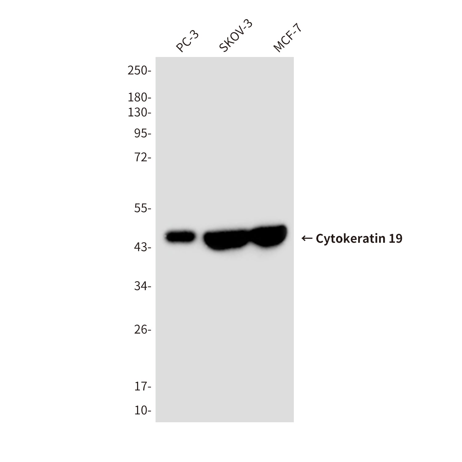Anti-Cytokeratin 19 (10G10) Mouse Monoclonal Antibody