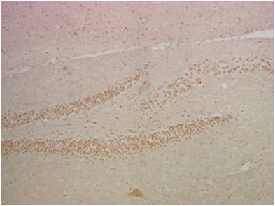 Anti-NF-KB p65 (5A10) Mouse Monoclonal Antibody