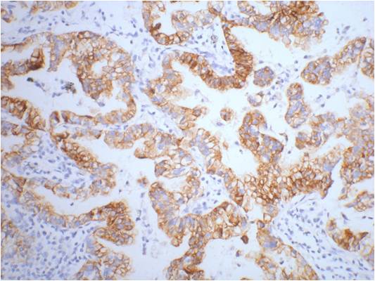 Anti-Cytokeratin 7 (9G9) Mouse Monoclonal Antibody