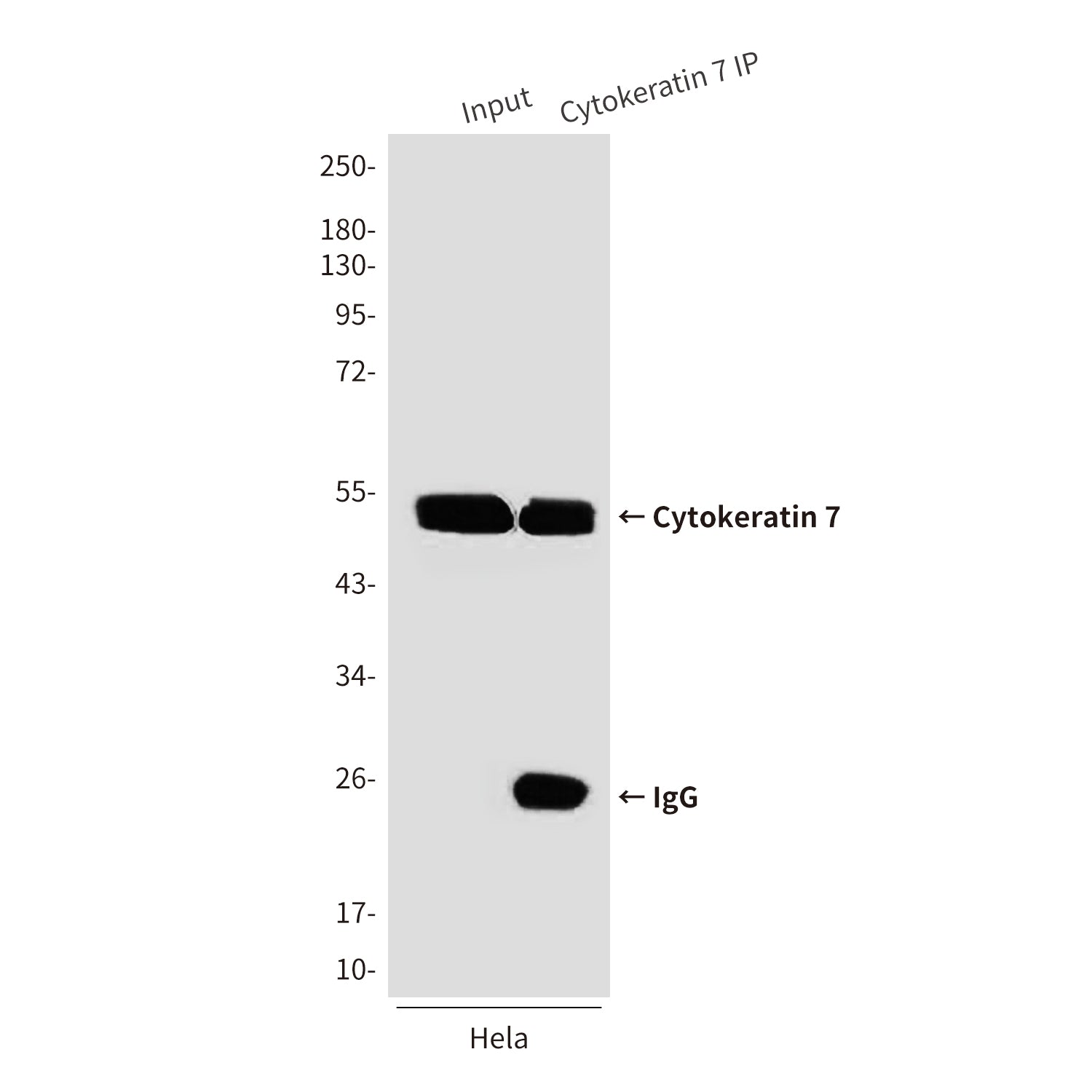 Anti-Cytokeratin 7 (9G9) Mouse Monoclonal Antibody