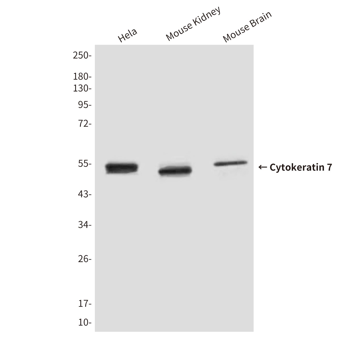 Anti-Cytokeratin 7 (9G9) Mouse Monoclonal Antibody