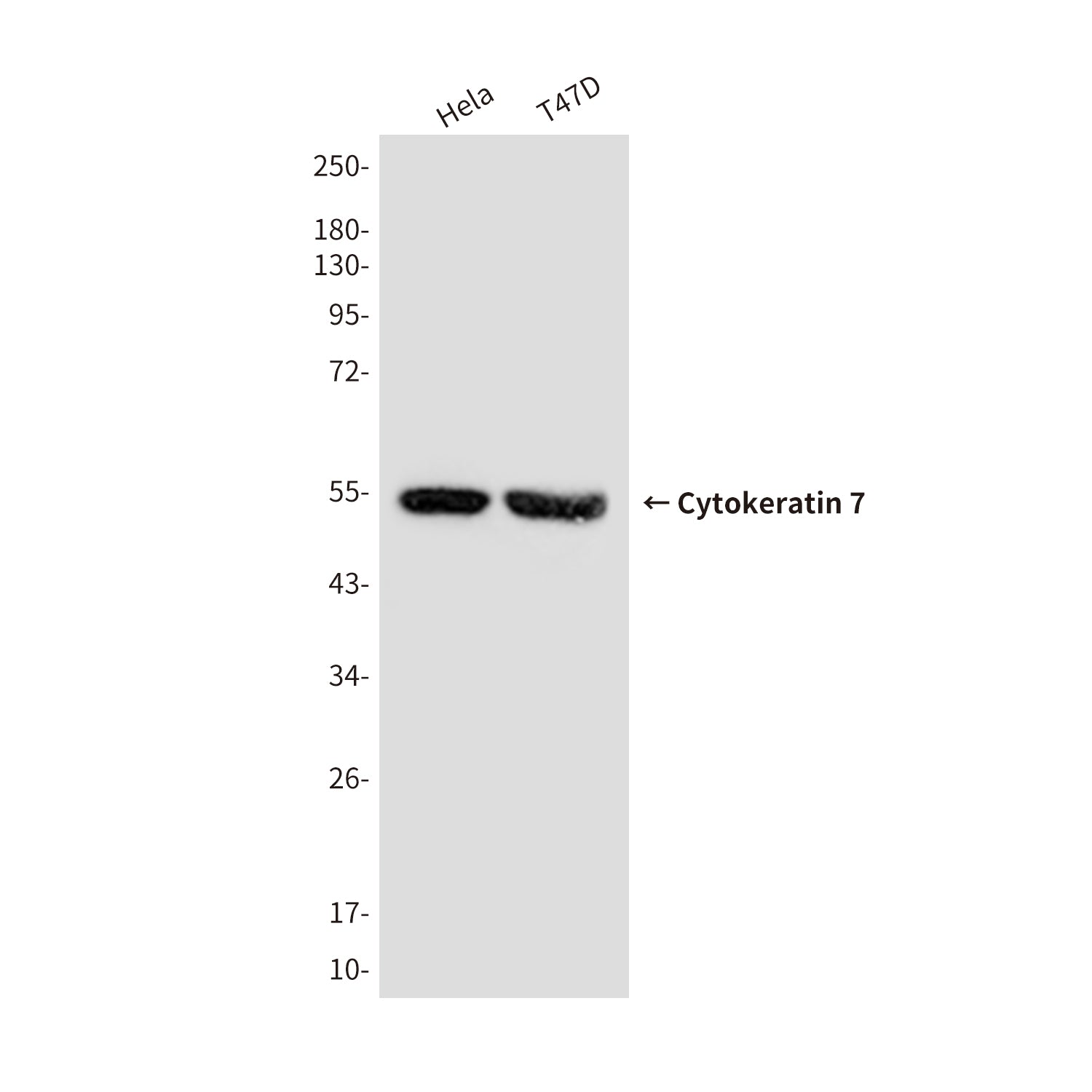Anti-Cytokeratin 7 (9G9) Mouse Monoclonal Antibody