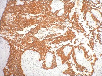 Anti-Cytokeratin 16 (10C7) Mouse Monoclonal Antibody