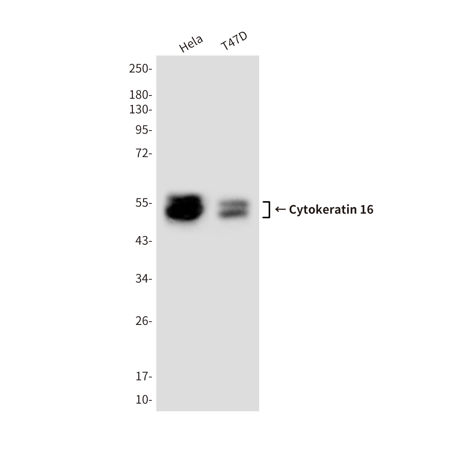 Anti-Cytokeratin 16 (10C7) Mouse Monoclonal Antibody