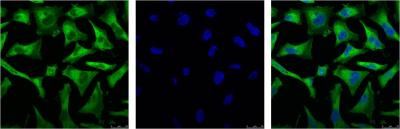 Anti-NF-KB p65 (3D2) Mouse Monoclonal Antibody