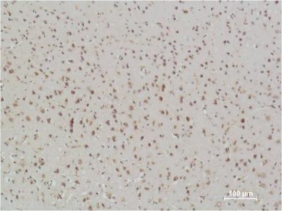 Anti-NF-KB p65 (3D2) Mouse Monoclonal Antibody
