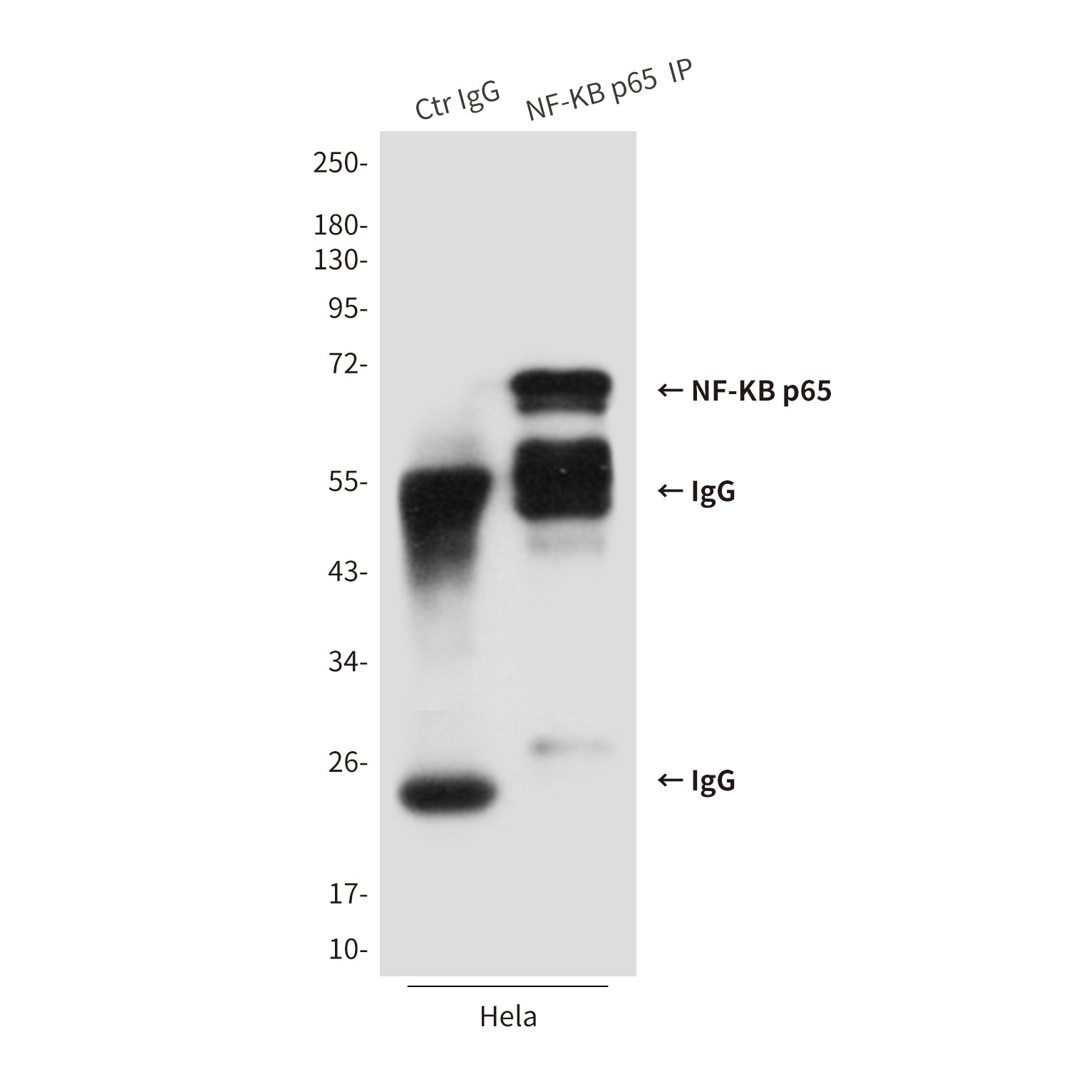 Anti-NF-KB p65 (3D2) Mouse Monoclonal Antibody
