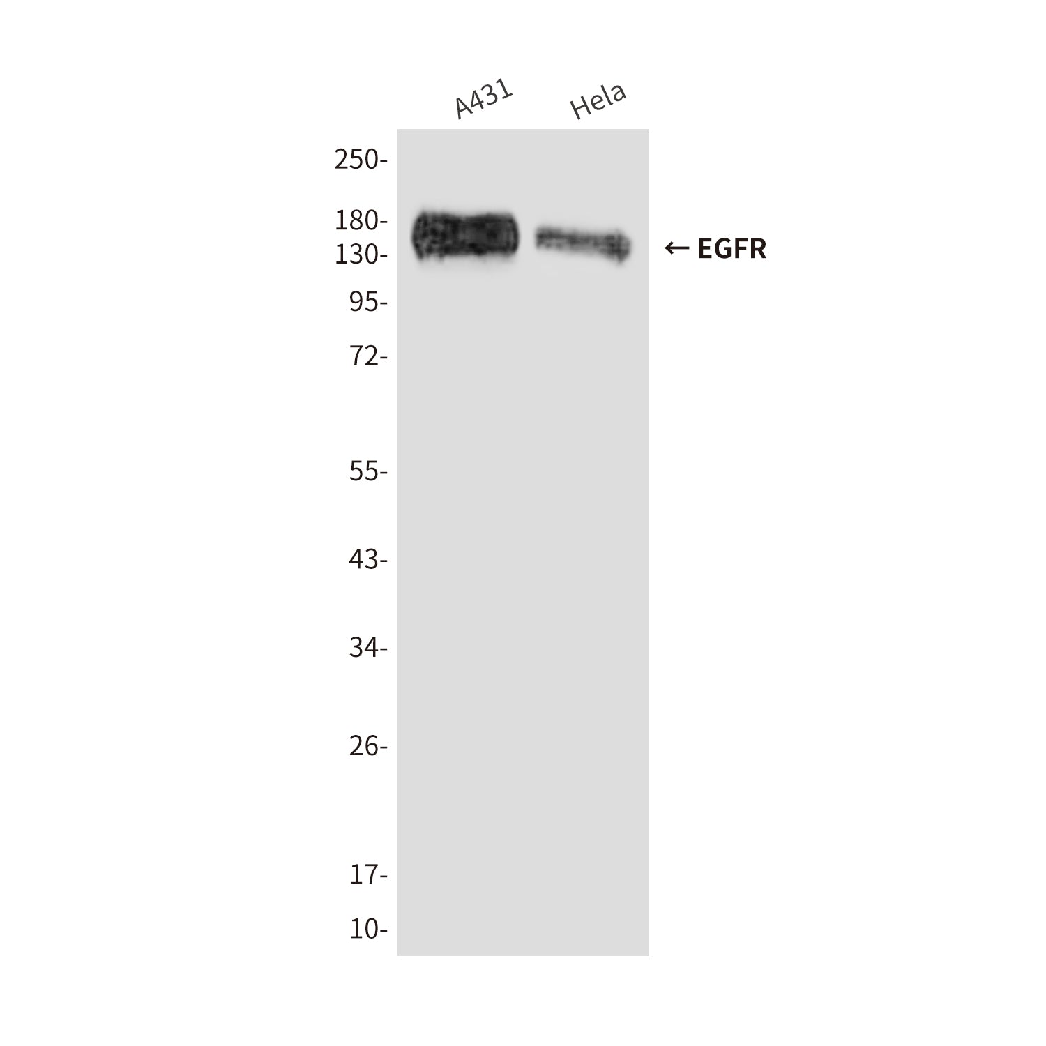Anti-EGFR (5E9) Mouse Monoclonal Antibody