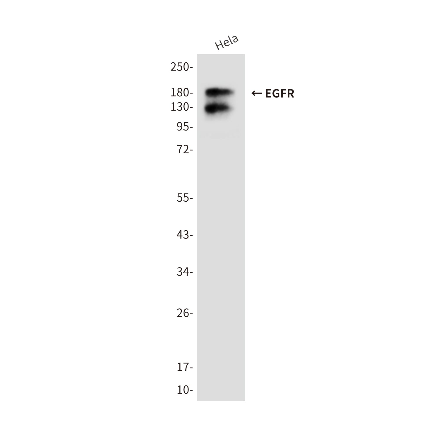 Anti-EGFR (5E9) Mouse Monoclonal Antibody