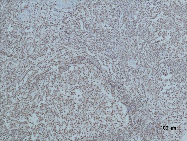 Anti-PARP1 (10C2) Mouse Monoclonal Antibody