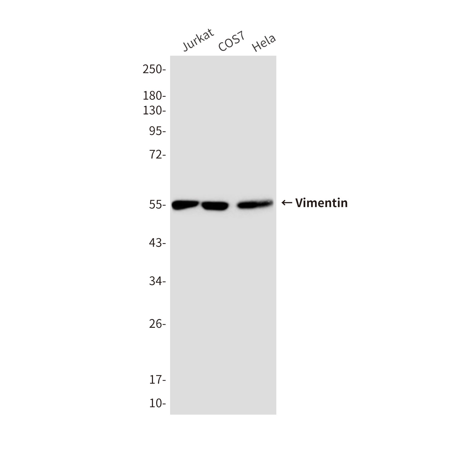 Anti-Vimentin (10E2) Mouse Monoclonal Antibody