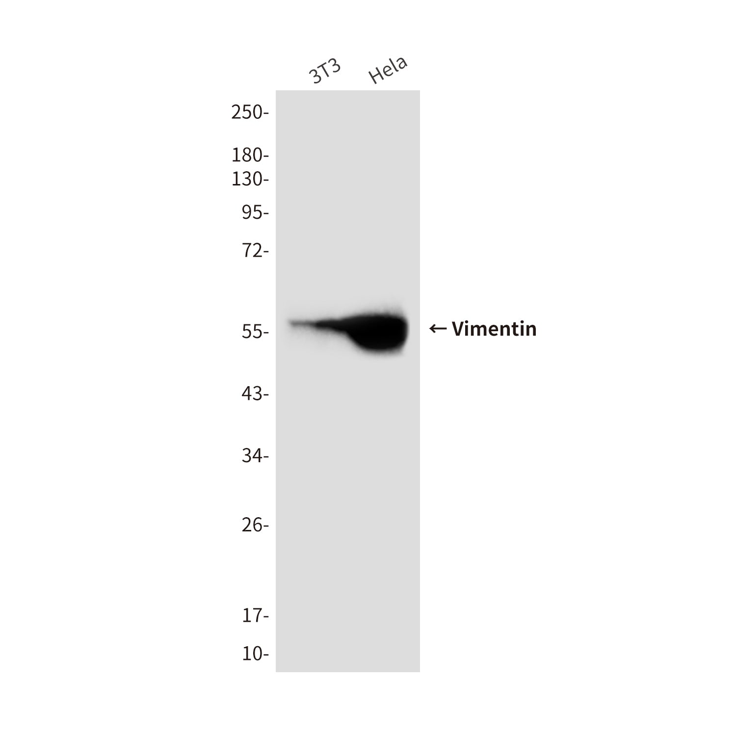 Anti-Vimentin (10E2) Mouse Monoclonal Antibody