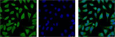 Anti-Hsp70 1A (1D9) Mouse Monoclonal Antibody