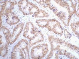 Anti-p53 (2D10) Mouse Monoclonal Antibody