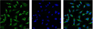 Anti-Peroxiredoxin 1 (6A6) Mouse Monoclonal Antibody