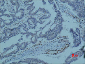 Anti-Survivin (8B9) Mouse Monoclonal Antibody