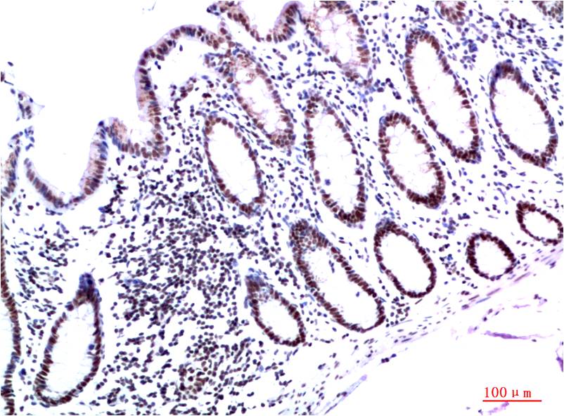 Anti-HP1 gamma (6D7) Mouse Monoclonal Antibody