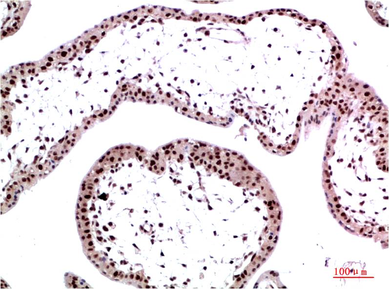 Anti-HP1 gamma (6D7) Mouse Monoclonal Antibody