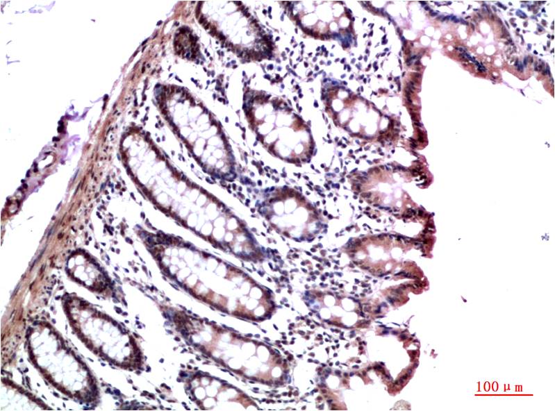 Anti-HP1 gamma (6D8) Mouse Monoclonal Antibody